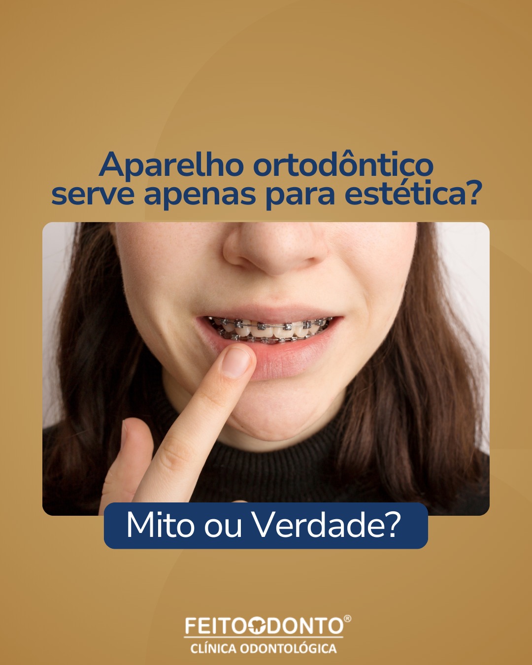 Aparelho ortodôntico serve apenas para estética?