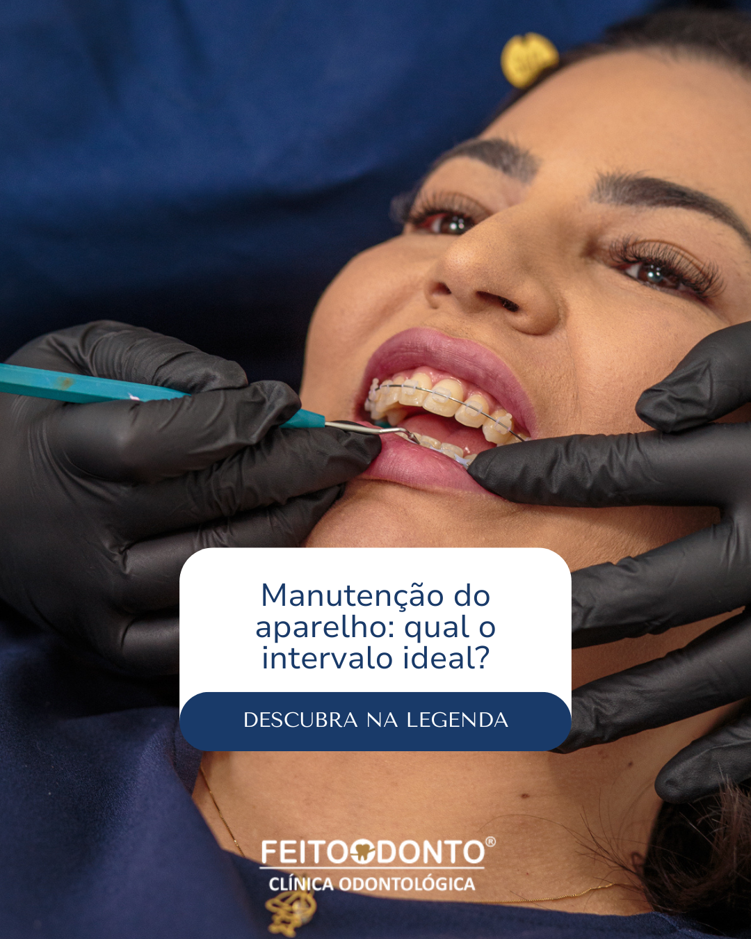 Manutenção do aparelho: qual o intervalo ideal?