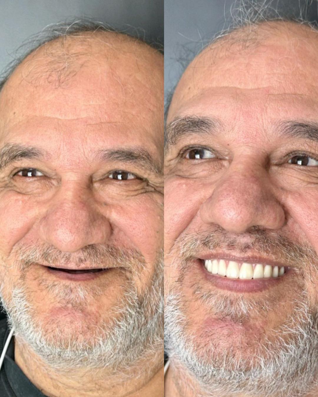 Prótese dentária