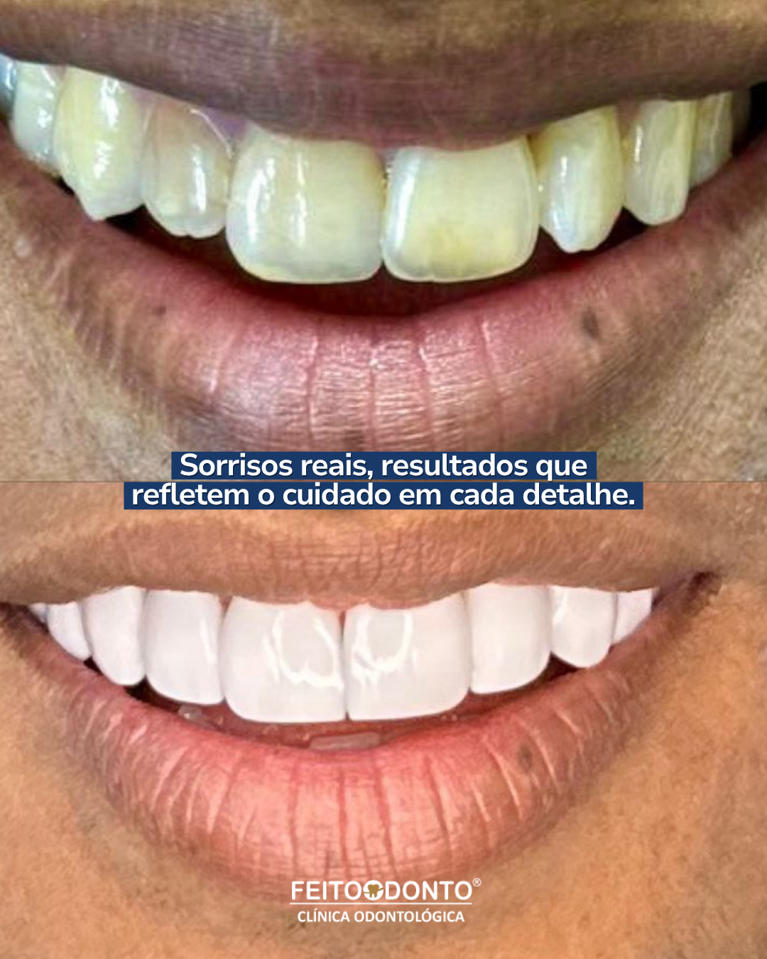 Sorrisos reais, resultados que refletem o cuidado em cada detalhe.